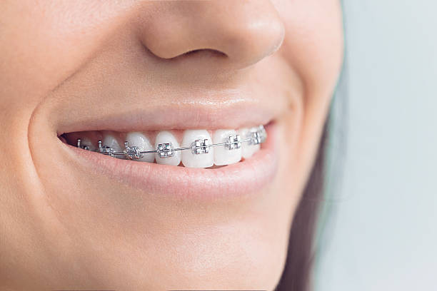 Best Teeth Whitening  in Messiah College, PA